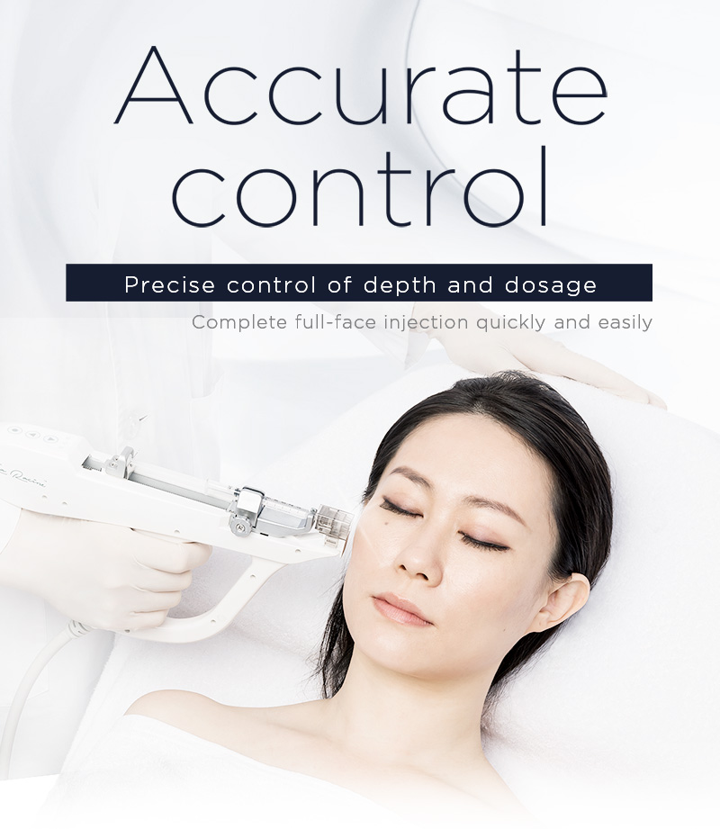 Accurate control
